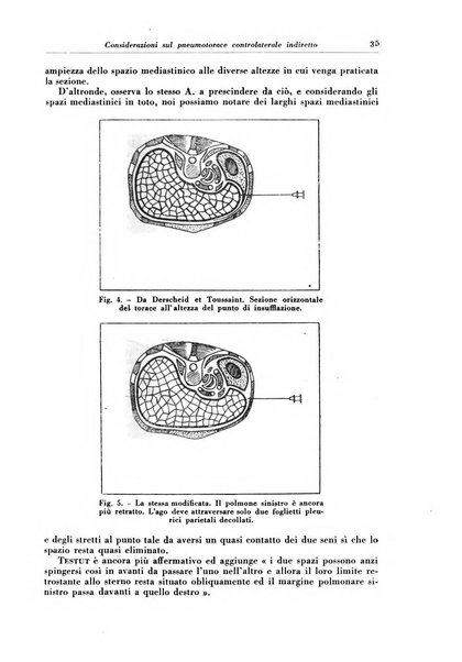 Rivista di patologia e clinica della tubercolosi organo ufficiale della Società italiana fascista di studi scientifici sulla tubercolosi