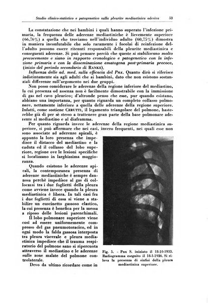 Rivista di patologia e clinica della tubercolosi organo ufficiale della Società italiana fascista di studi scientifici sulla tubercolosi