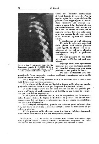 Rivista di patologia e clinica della tubercolosi organo ufficiale della Società italiana fascista di studi scientifici sulla tubercolosi