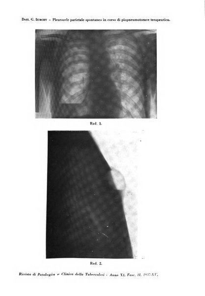 Rivista di patologia e clinica della tubercolosi organo ufficiale della Società italiana fascista di studi scientifici sulla tubercolosi