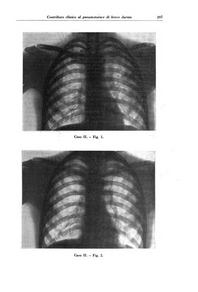 Rivista di patologia e clinica della tubercolosi organo ufficiale della Società italiana fascista di studi scientifici sulla tubercolosi