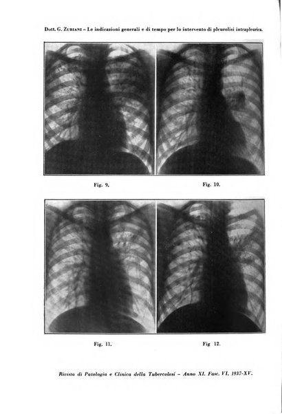 Rivista di patologia e clinica della tubercolosi organo ufficiale della Società italiana fascista di studi scientifici sulla tubercolosi