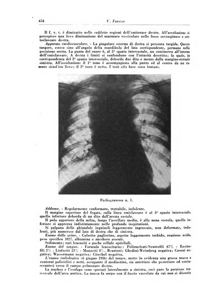 Rivista di patologia e clinica della tubercolosi organo ufficiale della Società italiana fascista di studi scientifici sulla tubercolosi