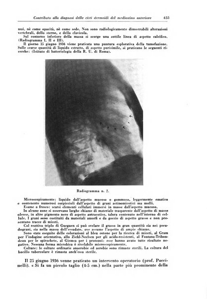 Rivista di patologia e clinica della tubercolosi organo ufficiale della Società italiana fascista di studi scientifici sulla tubercolosi