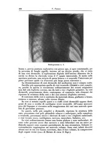 Rivista di patologia e clinica della tubercolosi organo ufficiale della Società italiana fascista di studi scientifici sulla tubercolosi