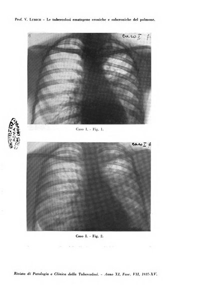 Rivista di patologia e clinica della tubercolosi organo ufficiale della Società italiana fascista di studi scientifici sulla tubercolosi