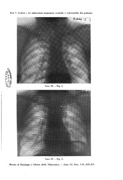 Rivista di patologia e clinica della tubercolosi organo ufficiale della Società italiana fascista di studi scientifici sulla tubercolosi