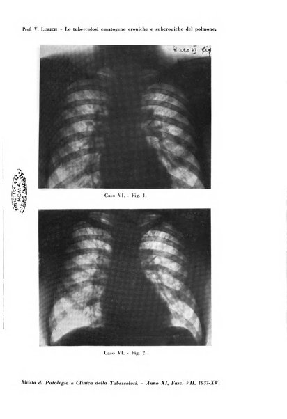 Rivista di patologia e clinica della tubercolosi organo ufficiale della Società italiana fascista di studi scientifici sulla tubercolosi