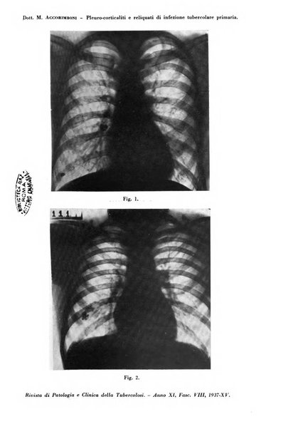 Rivista di patologia e clinica della tubercolosi organo ufficiale della Società italiana fascista di studi scientifici sulla tubercolosi