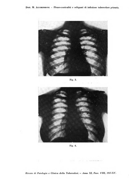 Rivista di patologia e clinica della tubercolosi organo ufficiale della Società italiana fascista di studi scientifici sulla tubercolosi