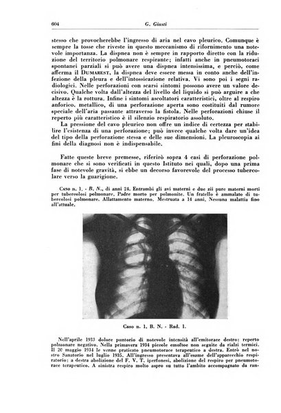 Rivista di patologia e clinica della tubercolosi organo ufficiale della Società italiana fascista di studi scientifici sulla tubercolosi