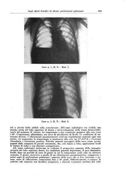 Rivista di patologia e clinica della tubercolosi organo ufficiale della Società italiana fascista di studi scientifici sulla tubercolosi