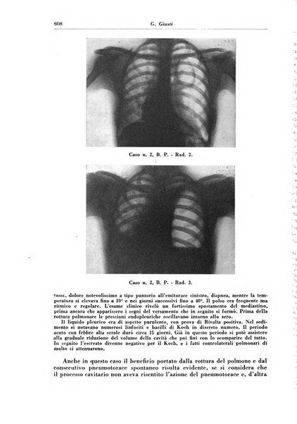 Rivista di patologia e clinica della tubercolosi organo ufficiale della Società italiana fascista di studi scientifici sulla tubercolosi