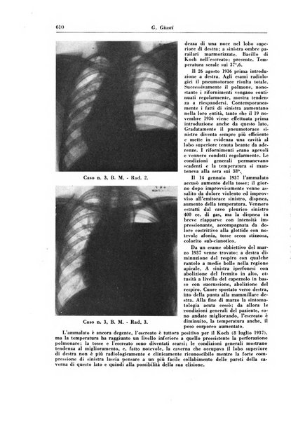 Rivista di patologia e clinica della tubercolosi organo ufficiale della Società italiana fascista di studi scientifici sulla tubercolosi