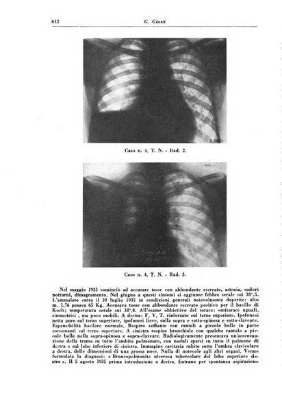 Rivista di patologia e clinica della tubercolosi organo ufficiale della Società italiana fascista di studi scientifici sulla tubercolosi