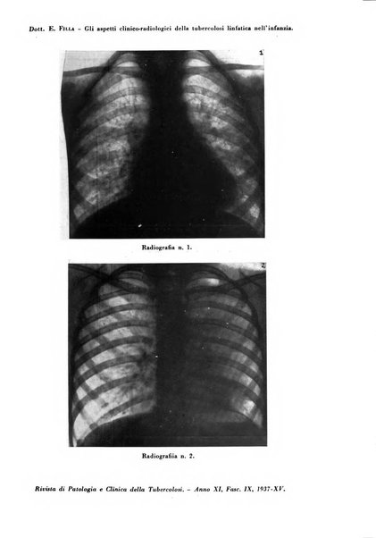 Rivista di patologia e clinica della tubercolosi organo ufficiale della Società italiana fascista di studi scientifici sulla tubercolosi