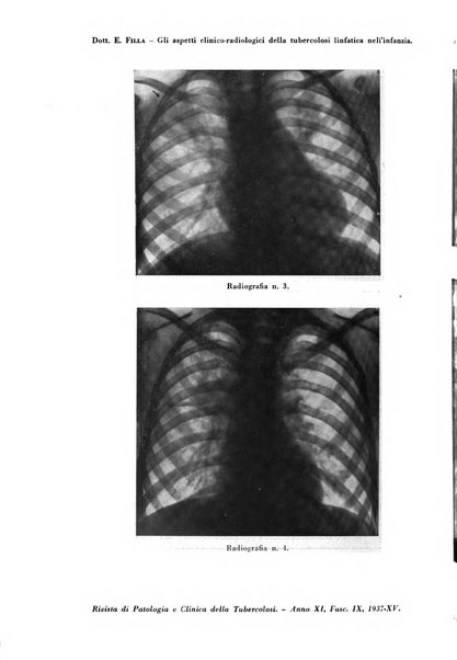 Rivista di patologia e clinica della tubercolosi organo ufficiale della Società italiana fascista di studi scientifici sulla tubercolosi