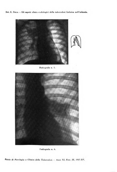 Rivista di patologia e clinica della tubercolosi organo ufficiale della Società italiana fascista di studi scientifici sulla tubercolosi