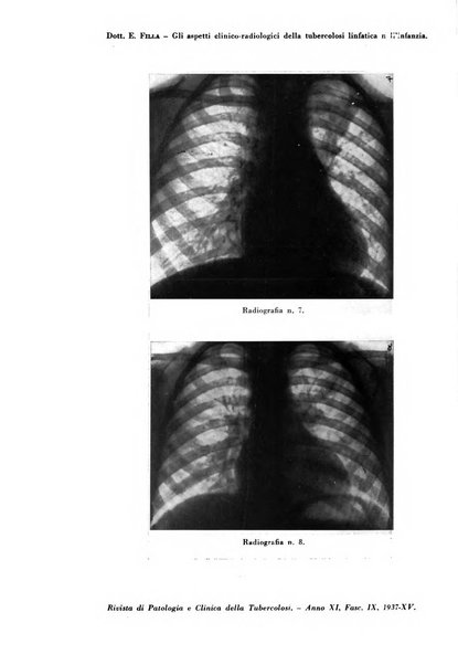 Rivista di patologia e clinica della tubercolosi organo ufficiale della Società italiana fascista di studi scientifici sulla tubercolosi