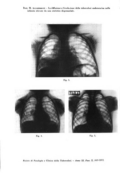 Rivista di patologia e clinica della tubercolosi organo ufficiale della Società italiana fascista di studi scientifici sulla tubercolosi