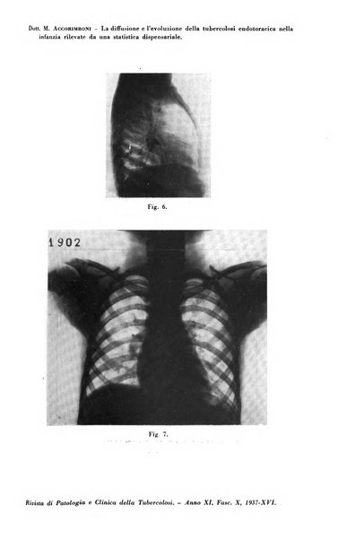 Rivista di patologia e clinica della tubercolosi organo ufficiale della Società italiana fascista di studi scientifici sulla tubercolosi