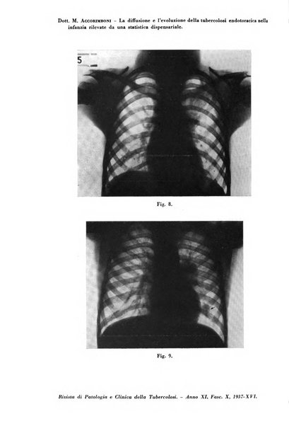 Rivista di patologia e clinica della tubercolosi organo ufficiale della Società italiana fascista di studi scientifici sulla tubercolosi