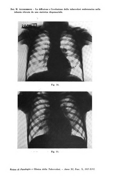 Rivista di patologia e clinica della tubercolosi organo ufficiale della Società italiana fascista di studi scientifici sulla tubercolosi