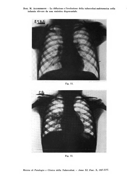 Rivista di patologia e clinica della tubercolosi organo ufficiale della Società italiana fascista di studi scientifici sulla tubercolosi