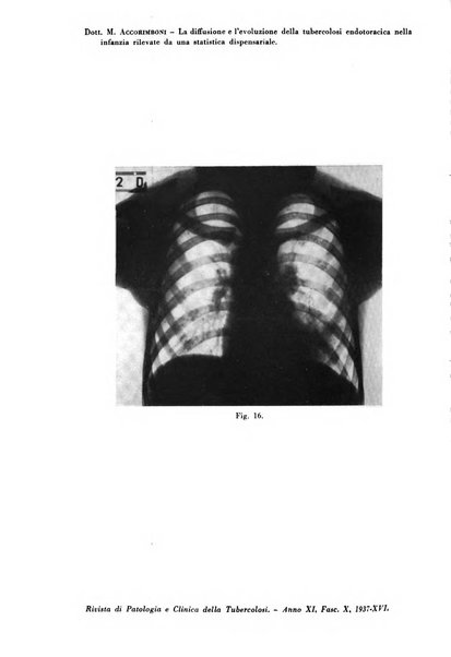 Rivista di patologia e clinica della tubercolosi organo ufficiale della Società italiana fascista di studi scientifici sulla tubercolosi