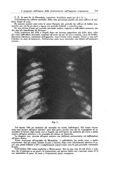 Rivista di patologia e clinica della tubercolosi organo ufficiale della Società italiana fascista di studi scientifici sulla tubercolosi