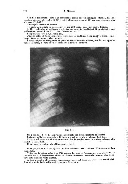 Rivista di patologia e clinica della tubercolosi organo ufficiale della Società italiana fascista di studi scientifici sulla tubercolosi