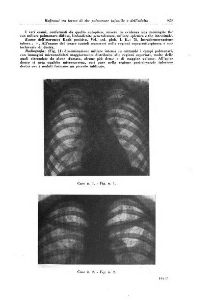 Rivista di patologia e clinica della tubercolosi organo ufficiale della Società italiana fascista di studi scientifici sulla tubercolosi