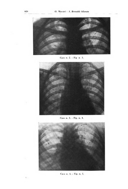 Rivista di patologia e clinica della tubercolosi organo ufficiale della Società italiana fascista di studi scientifici sulla tubercolosi