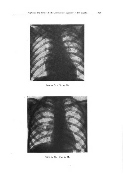 Rivista di patologia e clinica della tubercolosi organo ufficiale della Società italiana fascista di studi scientifici sulla tubercolosi