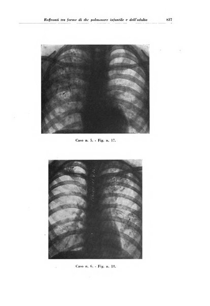 Rivista di patologia e clinica della tubercolosi organo ufficiale della Società italiana fascista di studi scientifici sulla tubercolosi