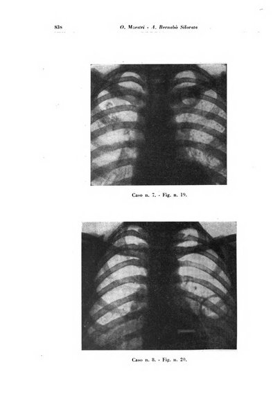 Rivista di patologia e clinica della tubercolosi organo ufficiale della Società italiana fascista di studi scientifici sulla tubercolosi