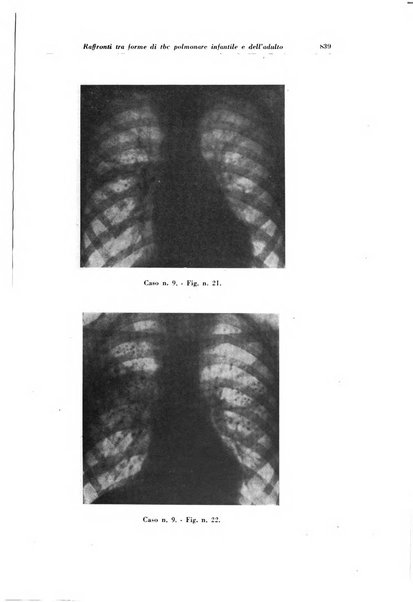 Rivista di patologia e clinica della tubercolosi organo ufficiale della Società italiana fascista di studi scientifici sulla tubercolosi