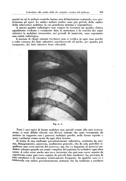 Rivista di patologia e clinica della tubercolosi organo ufficiale della Società italiana fascista di studi scientifici sulla tubercolosi