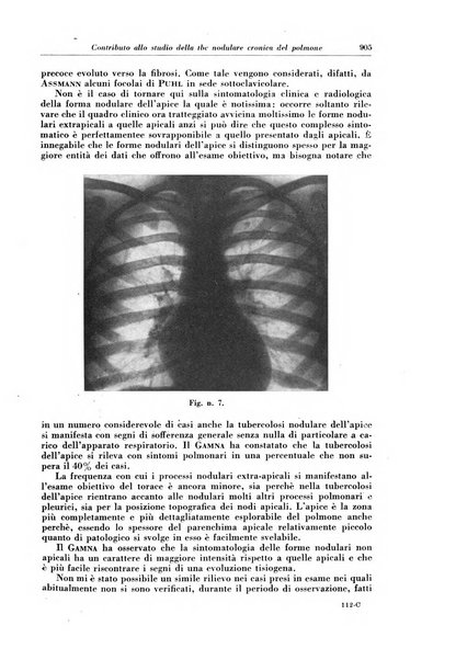 Rivista di patologia e clinica della tubercolosi organo ufficiale della Società italiana fascista di studi scientifici sulla tubercolosi