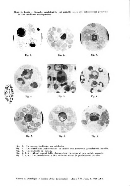 Rivista di patologia e clinica della tubercolosi organo ufficiale della Società italiana fascista di studi scientifici sulla tubercolosi