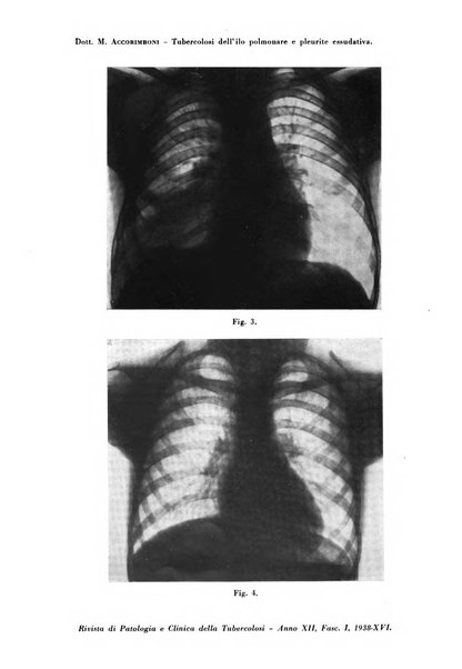 Rivista di patologia e clinica della tubercolosi organo ufficiale della Società italiana fascista di studi scientifici sulla tubercolosi