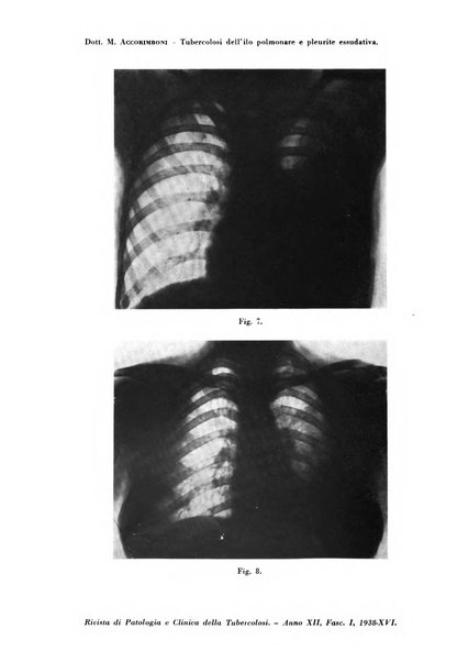 Rivista di patologia e clinica della tubercolosi organo ufficiale della Società italiana fascista di studi scientifici sulla tubercolosi