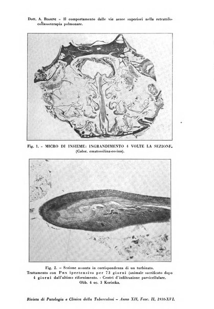 Rivista di patologia e clinica della tubercolosi organo ufficiale della Società italiana fascista di studi scientifici sulla tubercolosi