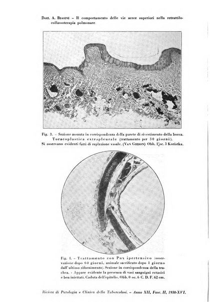 Rivista di patologia e clinica della tubercolosi organo ufficiale della Società italiana fascista di studi scientifici sulla tubercolosi