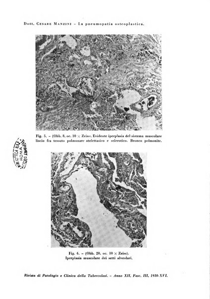 Rivista di patologia e clinica della tubercolosi organo ufficiale della Società italiana fascista di studi scientifici sulla tubercolosi