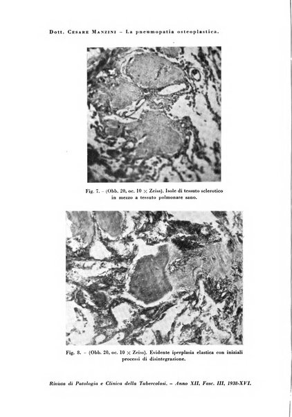 Rivista di patologia e clinica della tubercolosi organo ufficiale della Società italiana fascista di studi scientifici sulla tubercolosi