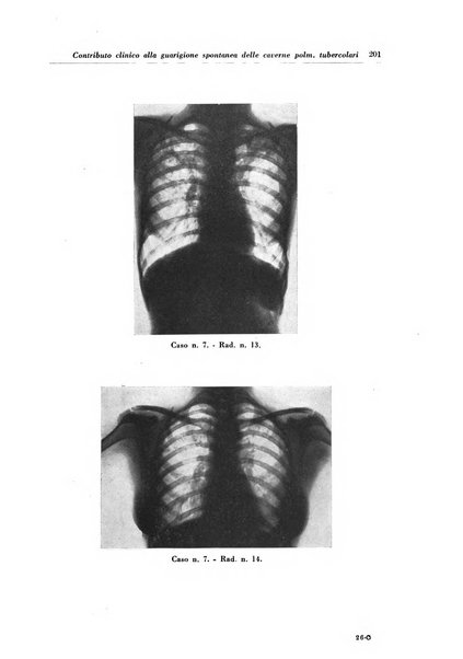 Rivista di patologia e clinica della tubercolosi organo ufficiale della Società italiana fascista di studi scientifici sulla tubercolosi