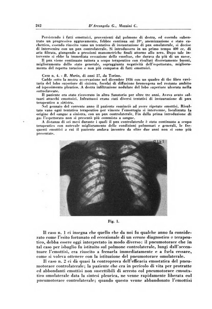 Rivista di patologia e clinica della tubercolosi organo ufficiale della Società italiana fascista di studi scientifici sulla tubercolosi