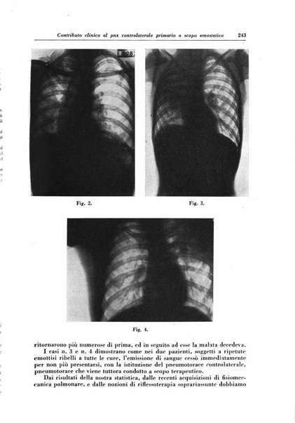 Rivista di patologia e clinica della tubercolosi organo ufficiale della Società italiana fascista di studi scientifici sulla tubercolosi