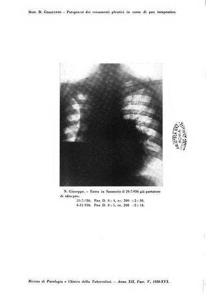 Rivista di patologia e clinica della tubercolosi organo ufficiale della Società italiana fascista di studi scientifici sulla tubercolosi